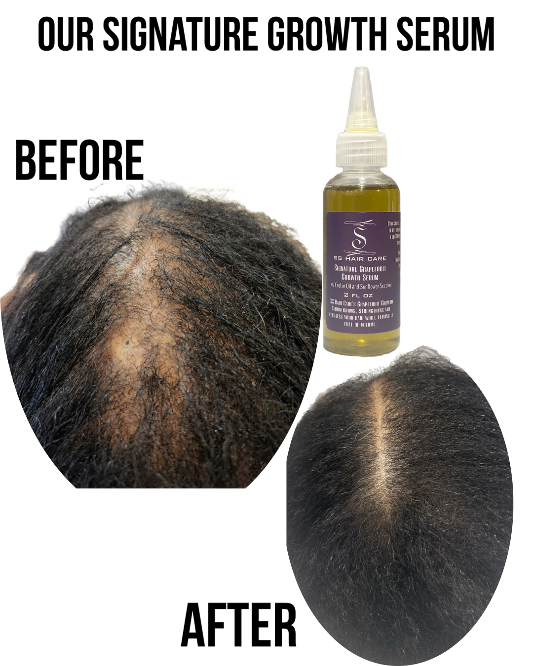 The All-Natural Hair Growth Solution by SS Hair Care®