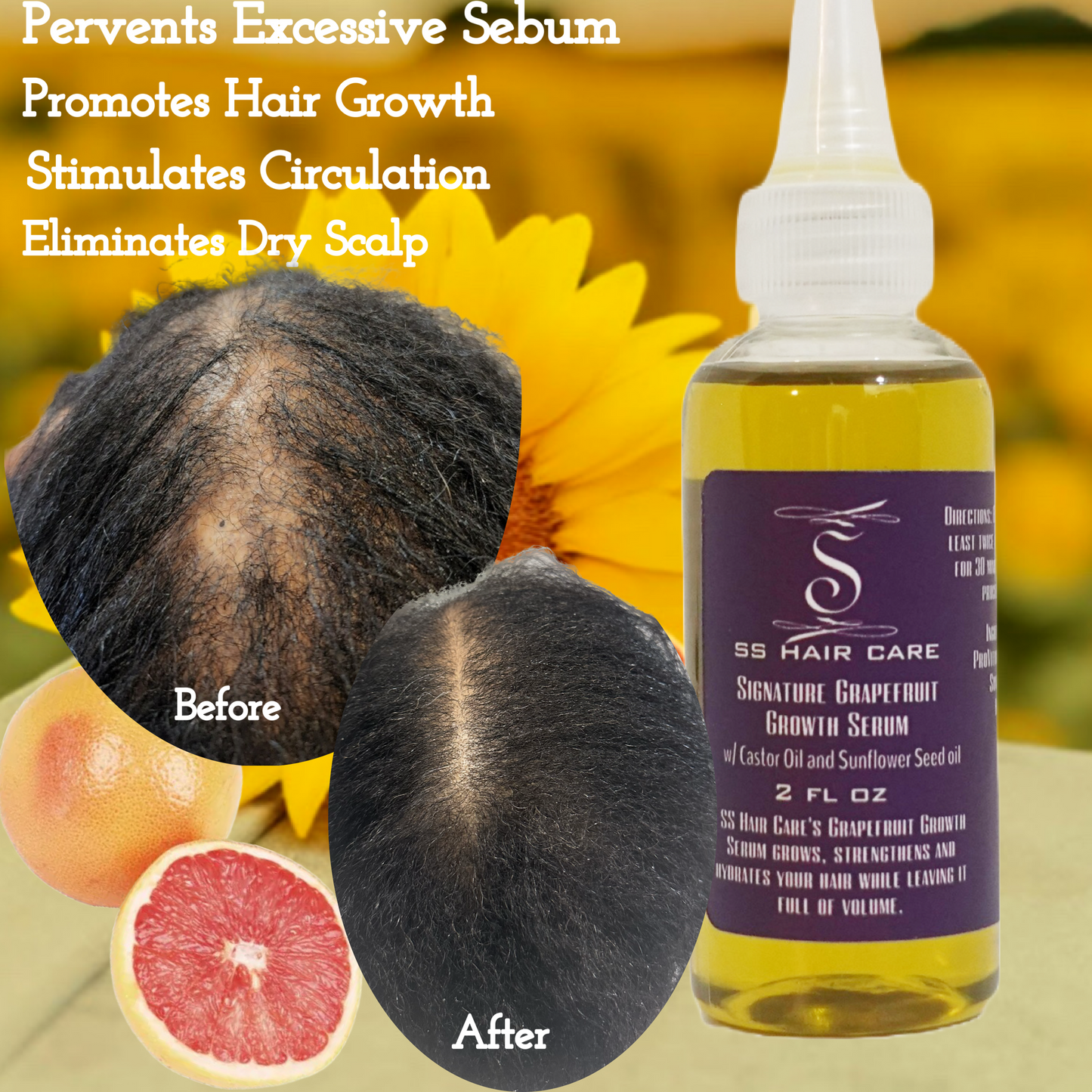 The All-Natural Hair Growth Solution by SS Hair Care®