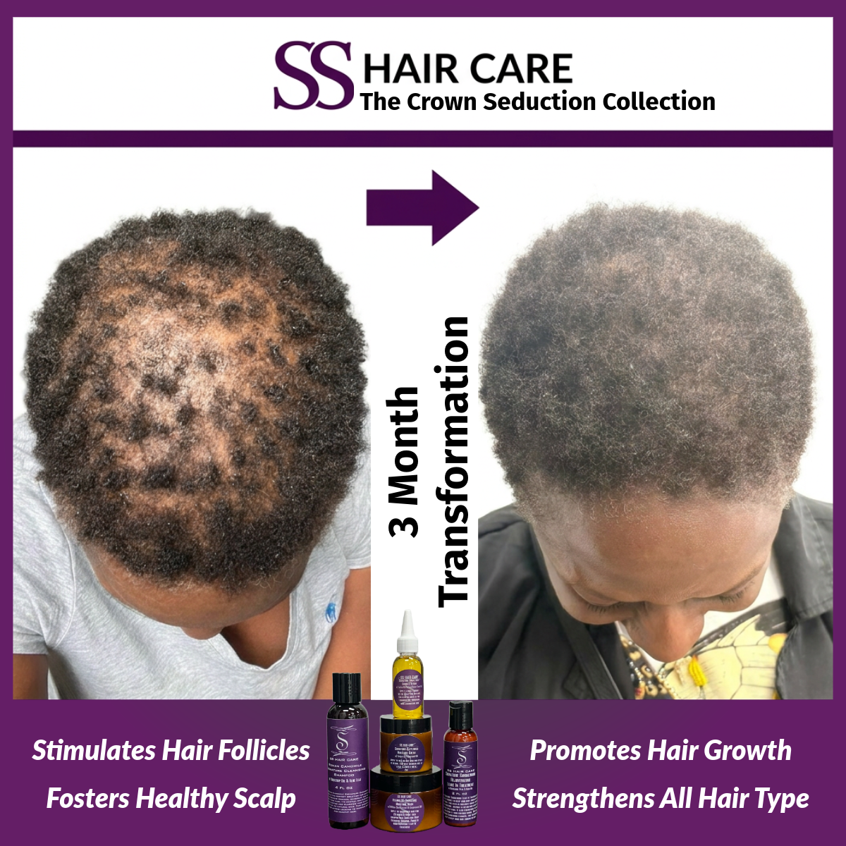 Load video: Hair and Scalp disorder
